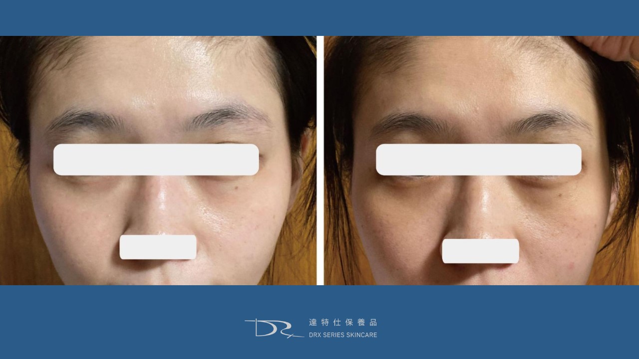 抗老最有效成分？30歲40歲抗老保養品？如何淡斑最有效？